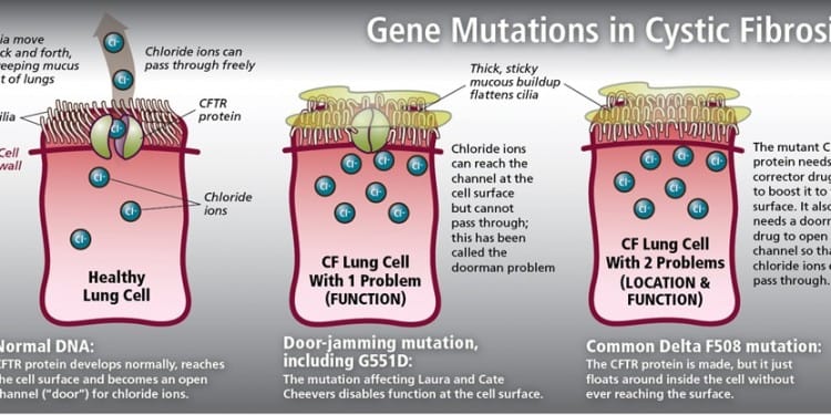 Cystic Fibrosis Genetics: Know Your CF Mutations